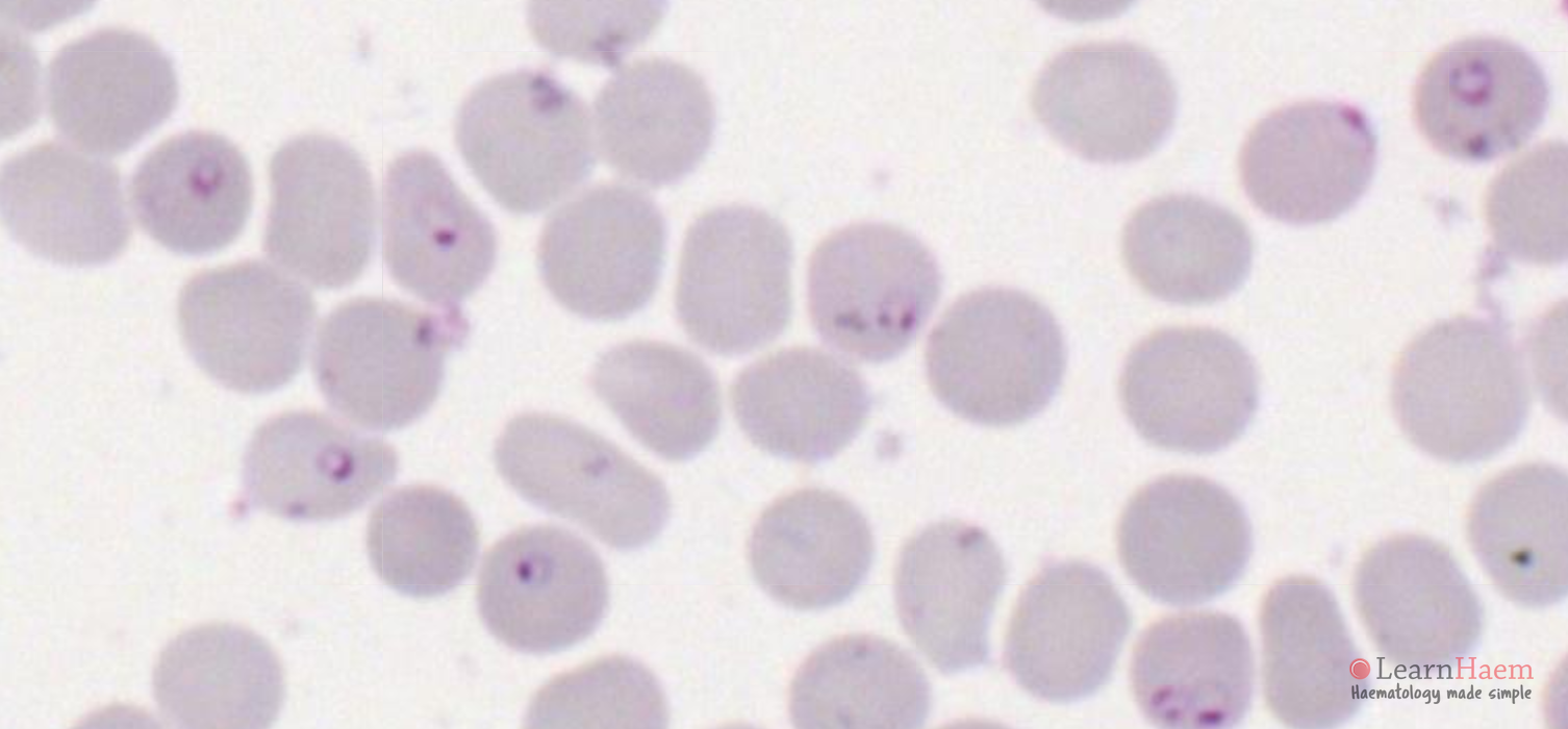 Effect of INA and AMO-1618 on intraerythrocytic development of P.... |  Download Scientific Diagram