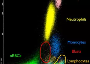 Flow Cytometry Gating Strategy: SSc against CD45.